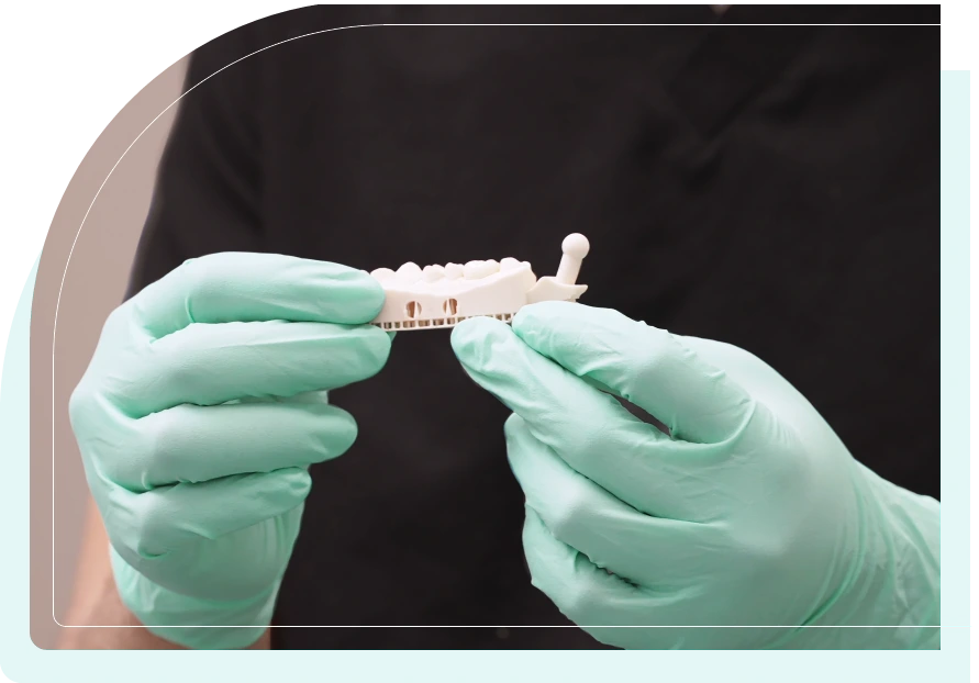 Preston Dental Group Offer same day Dental Crown